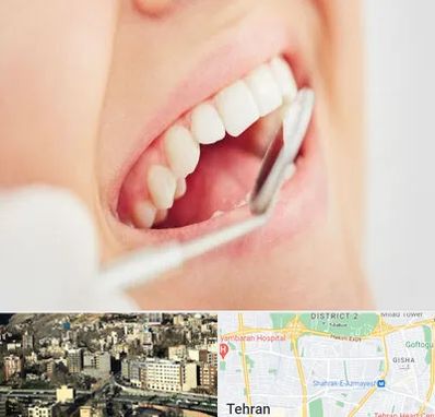 اصلاح طرح لبخند در مرزداران 