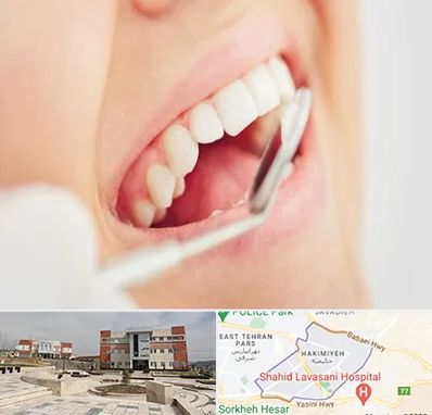 اصلاح طرح لبخند در حکیمیه 