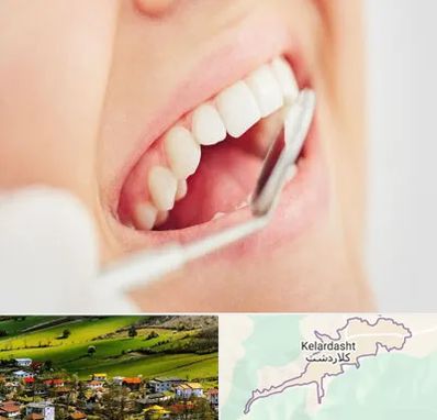 اصلاح طرح لبخند در کلاردشت