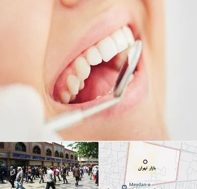 اصلاح طرح لبخند در بازار تهران