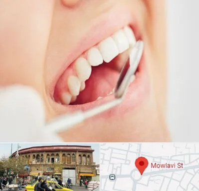 اصلاح طرح لبخند در مولوی