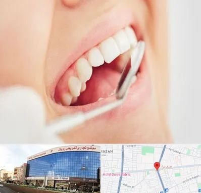 اصلاح طرح لبخند در نصف راه تبریز