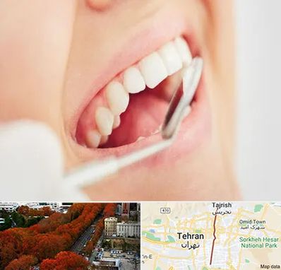 اصلاح طرح لبخند در ولیعصر 