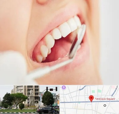 اصلاح طرح لبخند در میدان فردوسی تهران