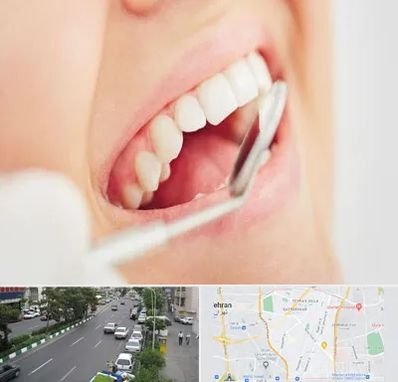 اصلاح طرح لبخند در ستارخان 