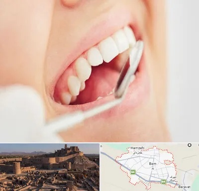 اصلاح طرح لبخند در بم