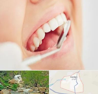 اصلاح طرح لبخند در کردان