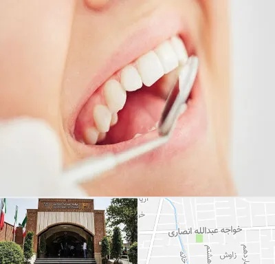 اصلاح طرح لبخند در خواجه عبدالله