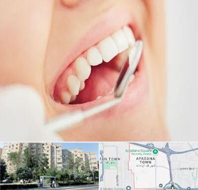 اصلاح طرح لبخند در آپادانا