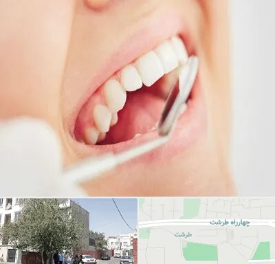 اصلاح طرح لبخند در طرشت