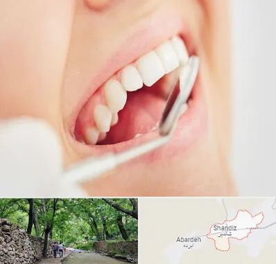 اصلاح طرح لبخند در شاندیز مشهد