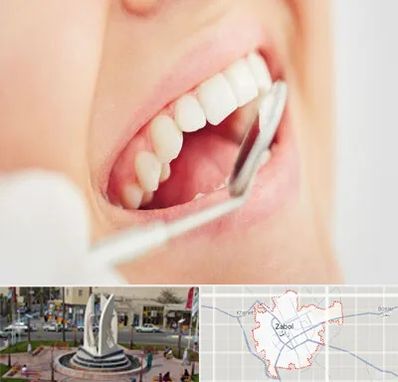 اصلاح طرح لبخند در زابل