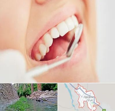 اصلاح طرح لبخند در سراوان