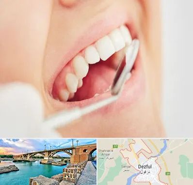 اصلاح طرح لبخند در دزفول