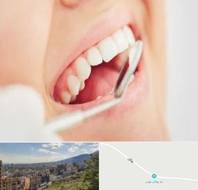 اصلاح طرح لبخند در بوکان تهران