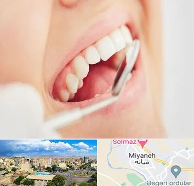 اصلاح طرح لبخند در میانه