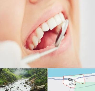 اصلاح طرح لبخند در رویان