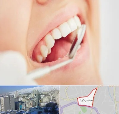 اصلاح طرح لبخند در محمودیه