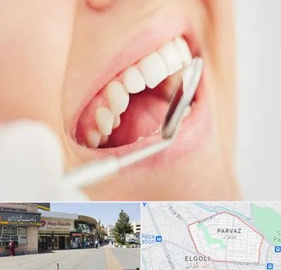 اصلاح طرح لبخند در پرواز تبریز