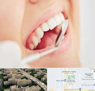 اصلاح طرح لبخند در اکباتان 