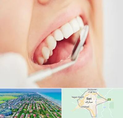 اصلاح طرح لبخند در ساری