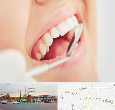 اصلاح طرح لبخند در میدان خراسان