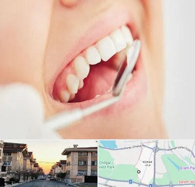 اصلاح طرح لبخند در کوهک