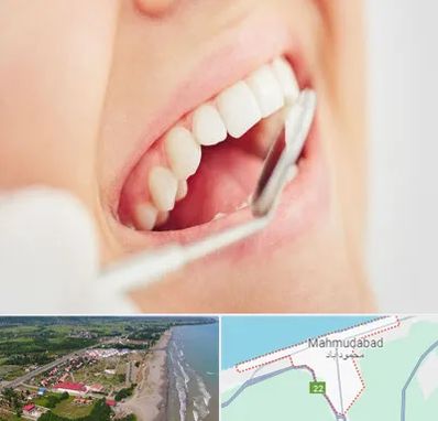 اصلاح طرح لبخند در محمودآباد