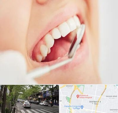 اصلاح طرح لبخند در ظفر 