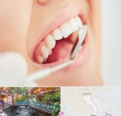 اصلاح طرح لبخند در درکه