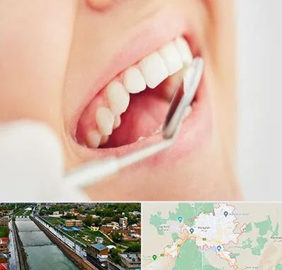 اصلاح طرح لبخند در مراغه