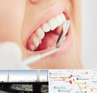 اصلاح طرح لبخند در پارک وی 