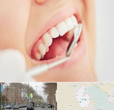 اصلاح طرح لبخند در نظرآباد کرج