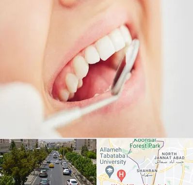 اصلاح طرح لبخند در شهران 