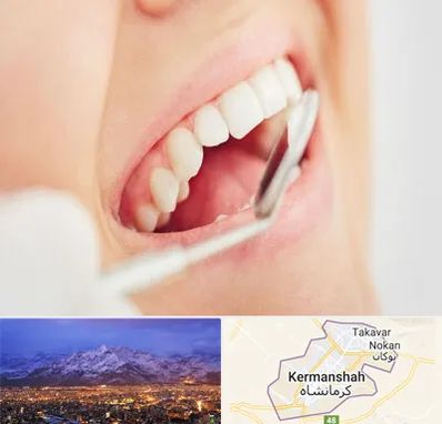 اصلاح طرح لبخند در کرمانشاه