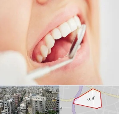 اصلاح طرح لبخند در آذری
