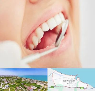 اصلاح طرح لبخند در نوشهر