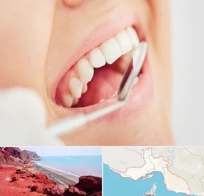 اصلاح طرح لبخند در هرمزگان