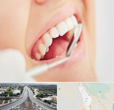 اصلاح طرح لبخند در اندیمشک