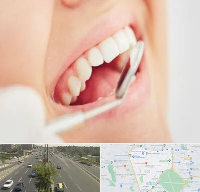 اصلاح طرح لبخند در منطقه 17 تهران