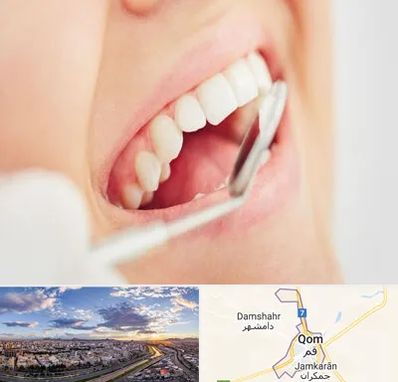 اصلاح طرح لبخند در قم