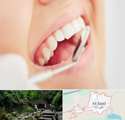 اصلاح طرح لبخند در علی آباد کتول