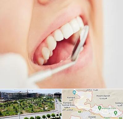 اصلاح طرح لبخند در پردیس