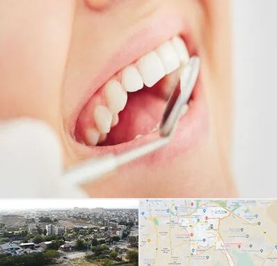 اصلاح طرح لبخند در منطقه 20 تهران