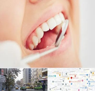 اصلاح طرح لبخند در فاطمی