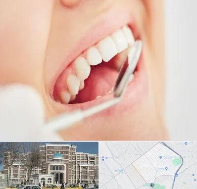 اصلاح طرح لبخند در طلاب مشهد