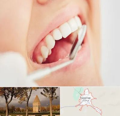 اصلاح طرح لبخند در تویسرکان