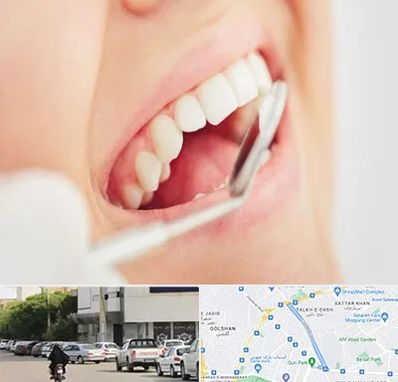 اصلاح طرح لبخند در قدوسی شرقی شیراز