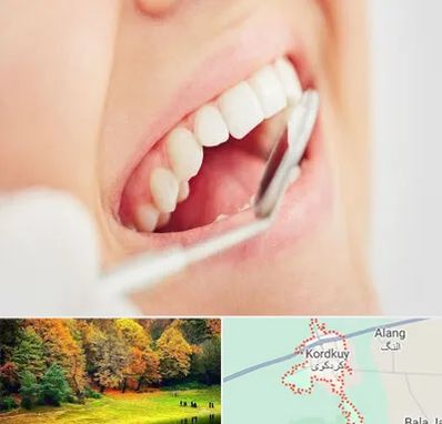 اصلاح طرح لبخند در کردکوی