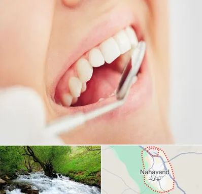 اصلاح طرح لبخند در نهاوند